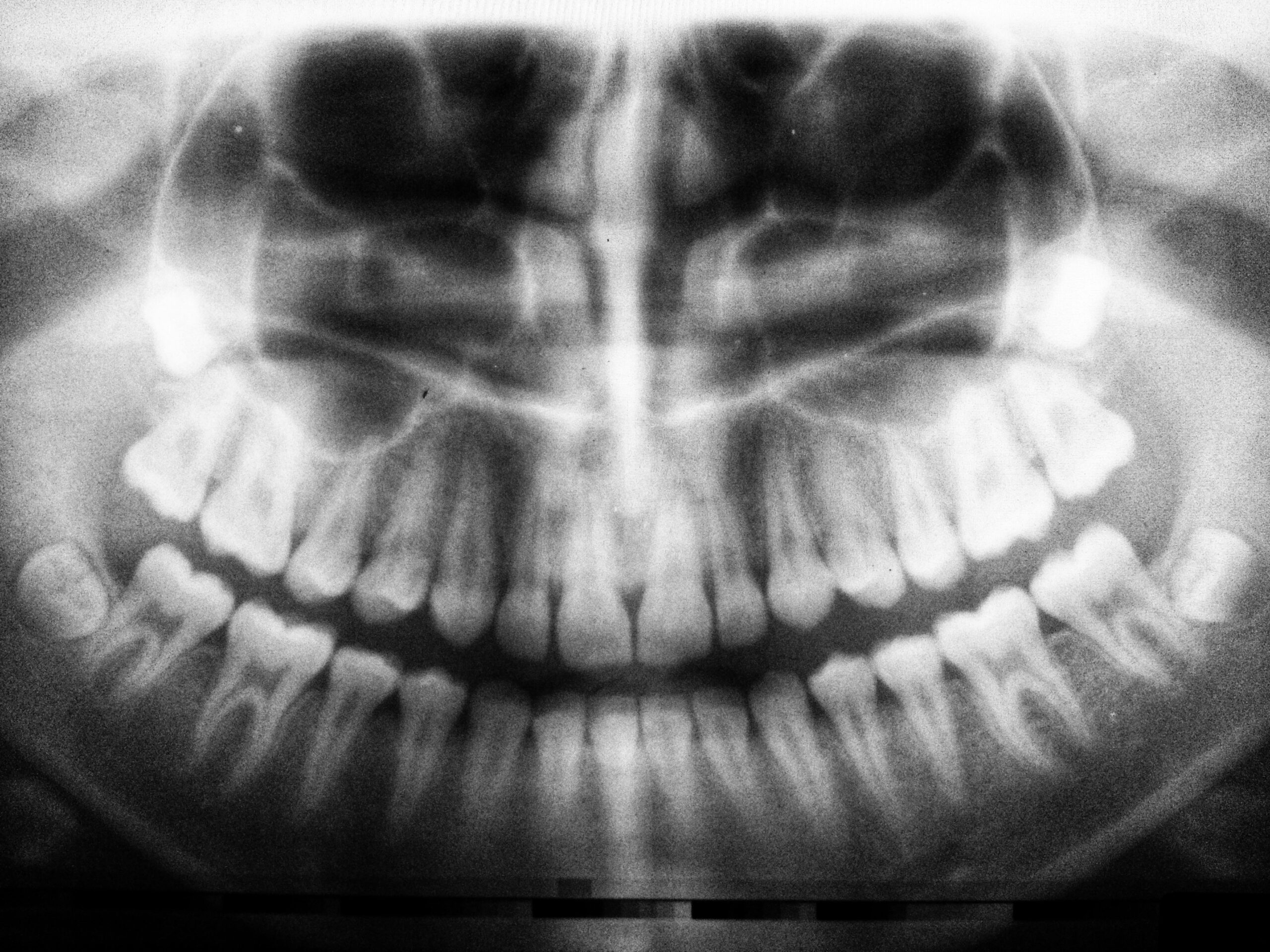 Cómo Usar un Irrigador Dental Correctamente: Paso a Paso para una Limpieza Efectiva